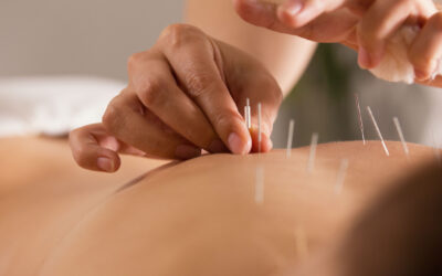 Is Acupuncture Beneficial For Stroke Rehabilitation?